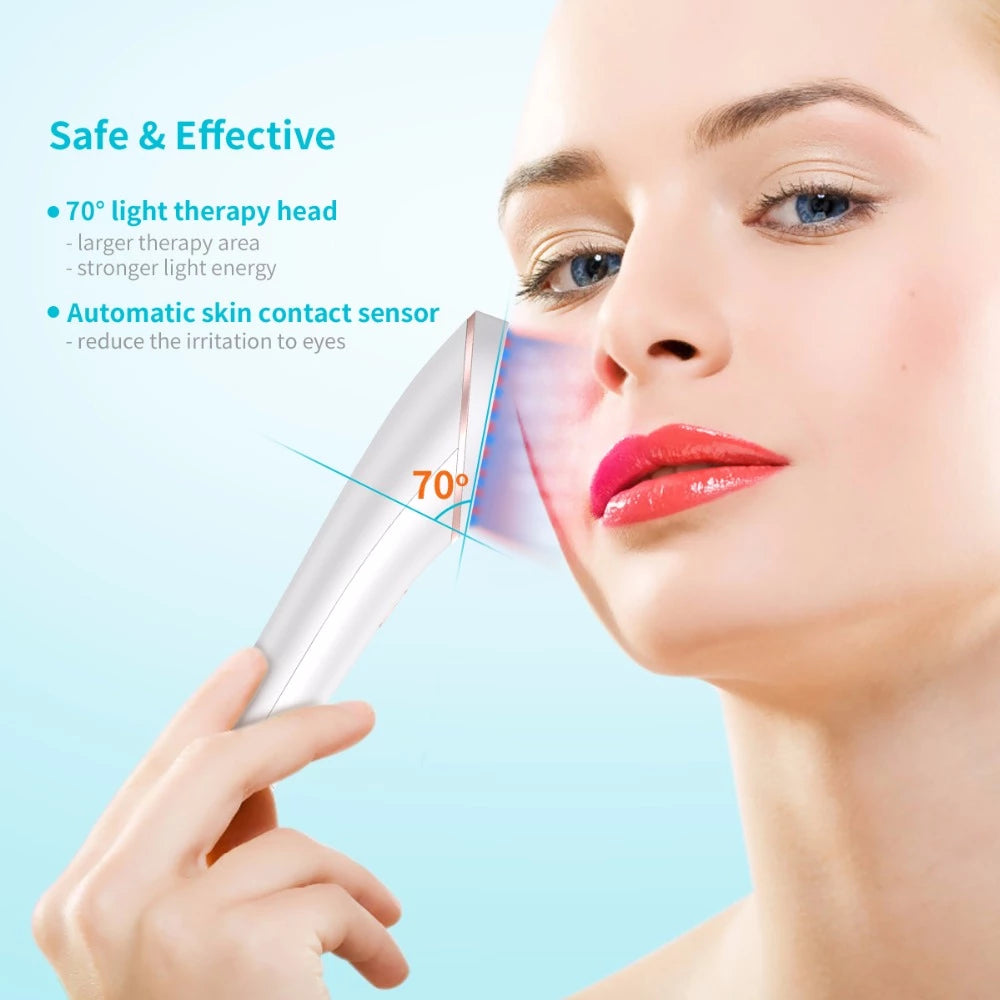 Akne-Lichttherapie Xpreen Kabelloses, wiederaufladbares Aknebehandlungsgerät Akne-Clear-Eraser mit blauem und rotem Licht